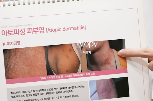생기한의원 아토피 페이지에서 확인하는 홍반과 각질 정보